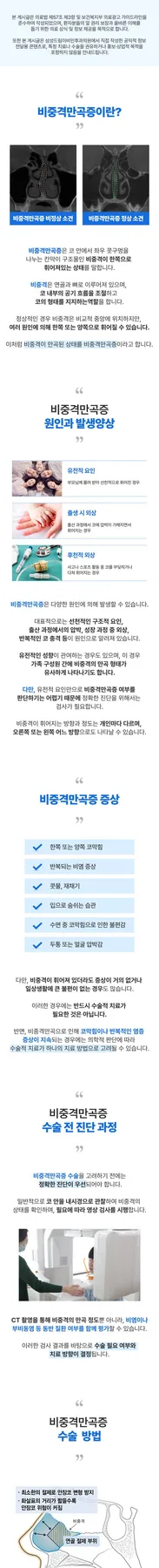 비중격만곡증 수술, 2026년 안전하게 진행하는 방법 3가지