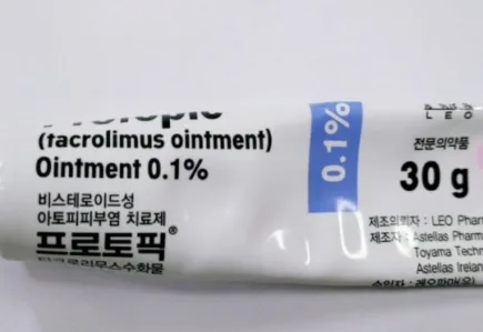 백반증 치료 루틴 2026: 15년차 환우의 실제 관리법