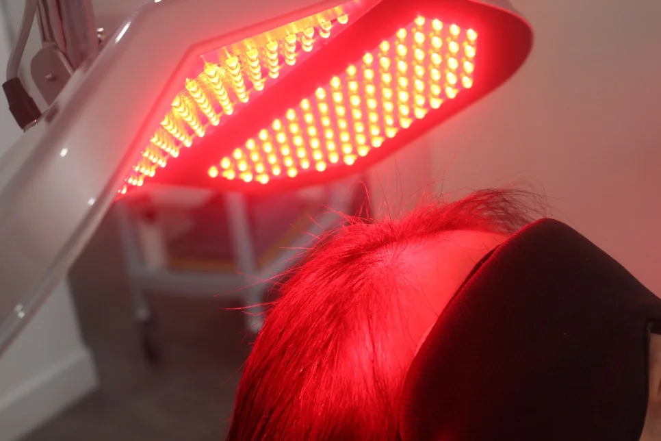 Korean Hair Loss Guide 2026: Why Early Action Matters