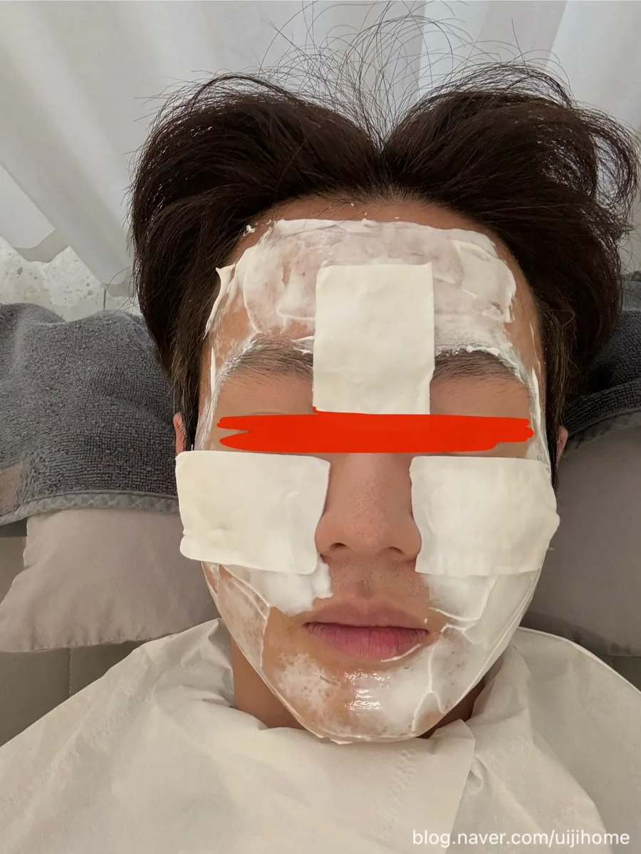 Korean PN Injection 3rd Session Review 2026: Pain, Effects & Care