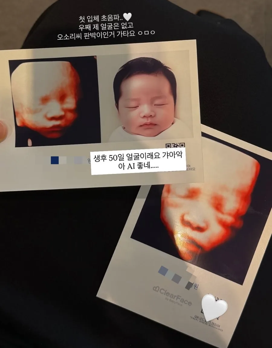 김지영 AI 예측 아기 얼굴 공개 2026: 초음파부터 기대 반응까지
