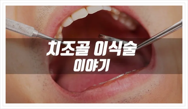 치조골이식술 보험금 청구 방법 2026: 실손 보상 사례 총정리