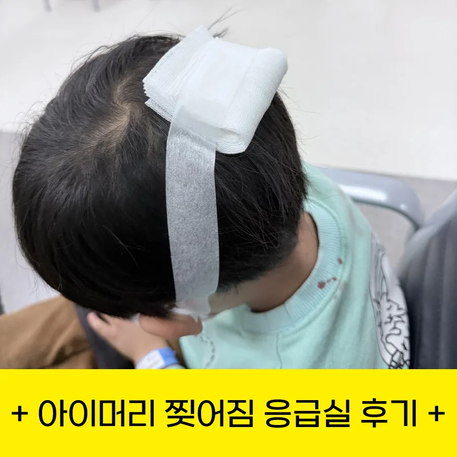 아이 머리 찢어짐 응급처치: 스테이플러 시술 후기 및 주의사항 2026