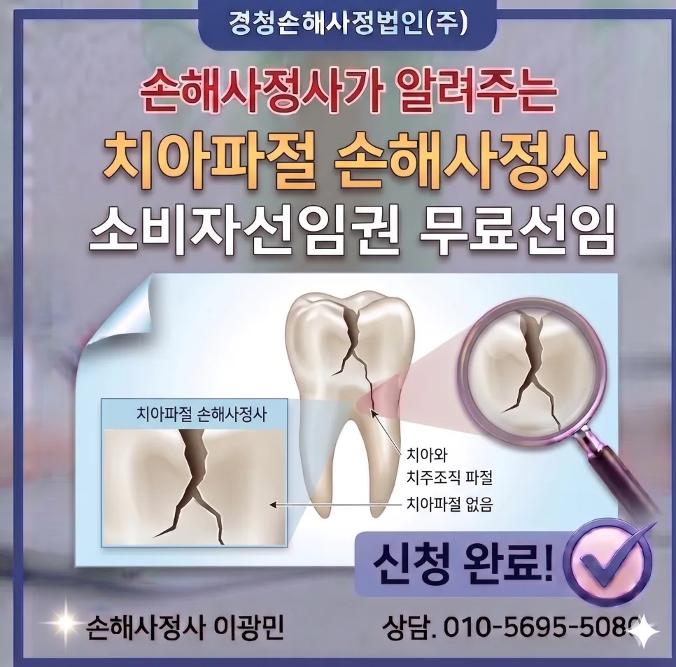 치아파절 보험금 2026: 소비자 선임권으로 무료 손해사정 받는 법