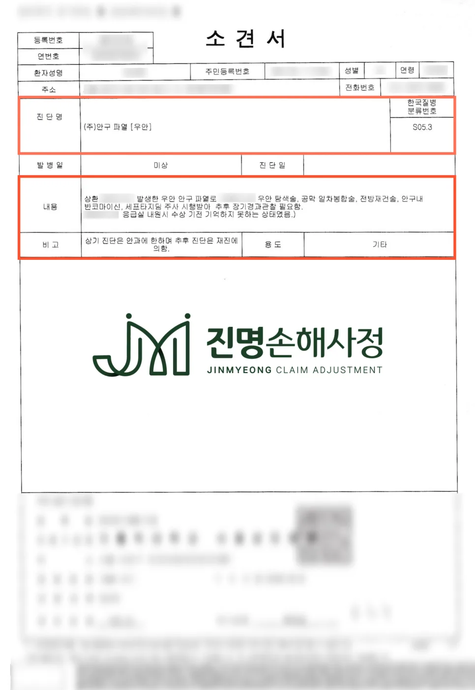 안와골절 실명 50% 보상, 낙상사고 후유장해 보험금 받는 법 2026