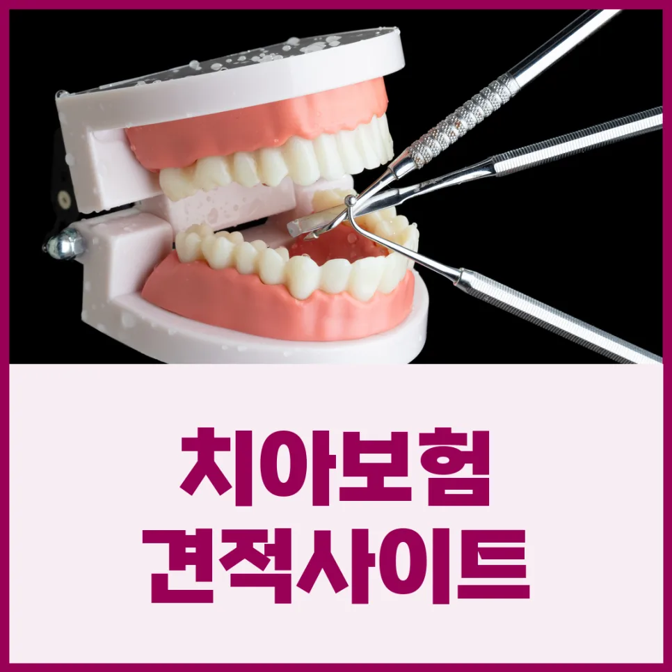 어린이 치아보험 2026년 핵심 보장 비교: 면책기간부터 치료별 적용까지