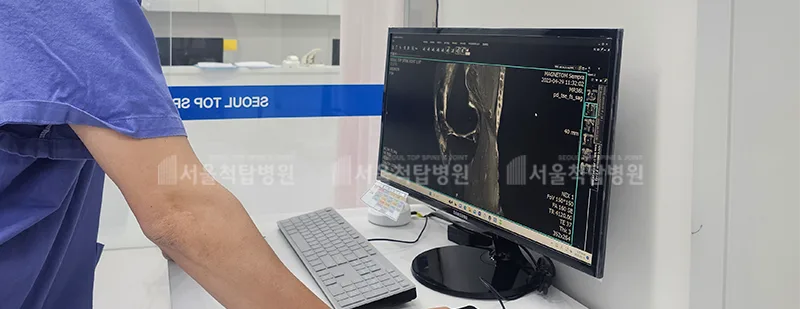 무릎 통증, 관절내시경이 필요한 순간은? 2026년 최신 정보 2