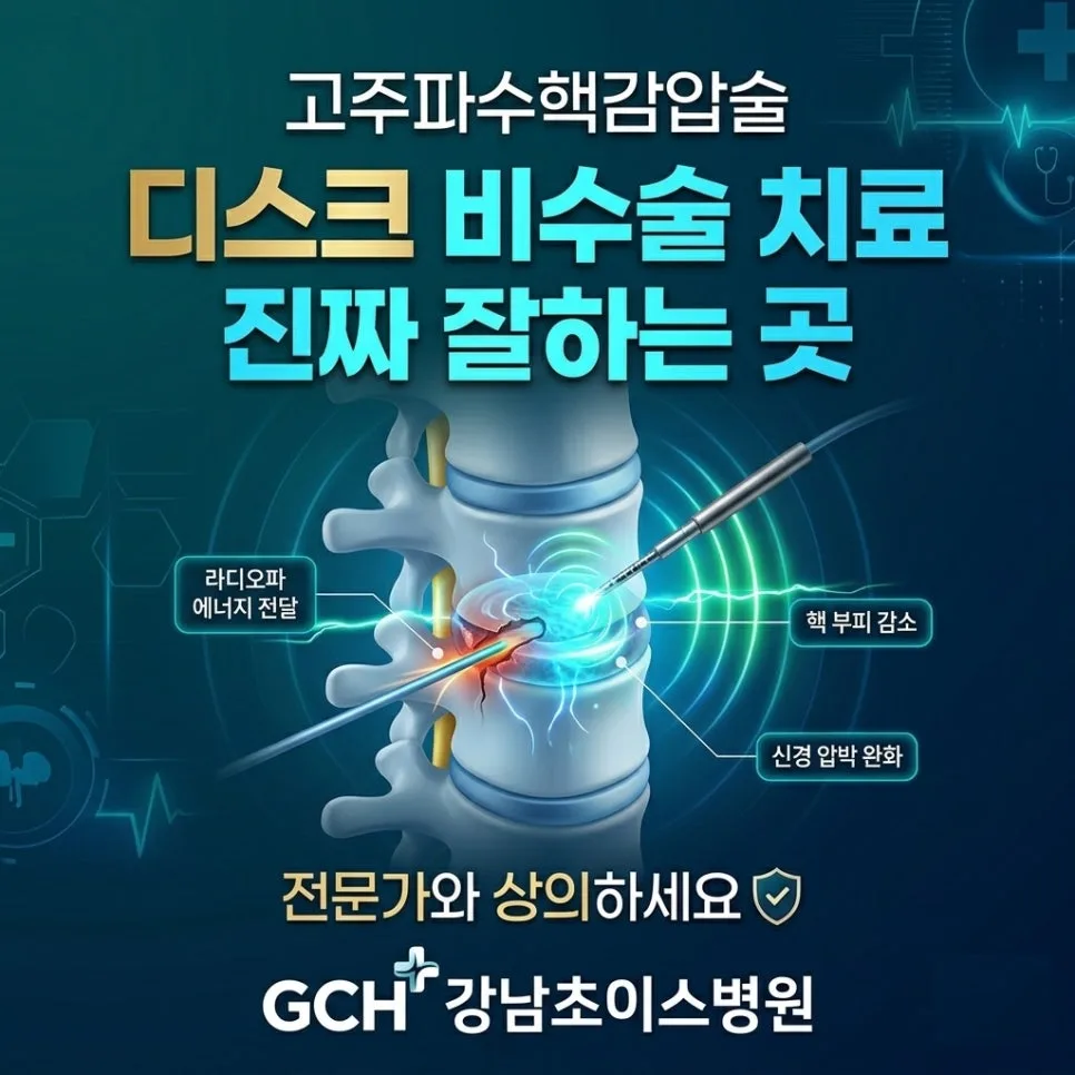 고주파수핵감압술 효과, 정말 없을까? 2026년 팩트체크
