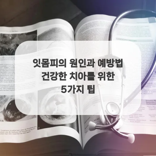 잇몸에서 피 나는 이유와 예방법 2026년 총정리
