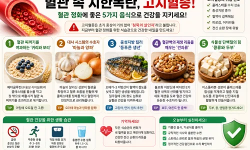 2026년 개별 종목 레버리지 ETF 14개 상장: 삼성전자·하이닉스 2배 수익 가능? 2