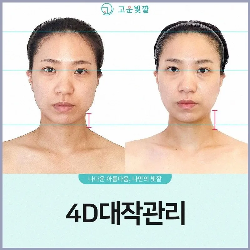 광주 피부관리 2026: 봄철 트러블 케어 효과 3가지 3