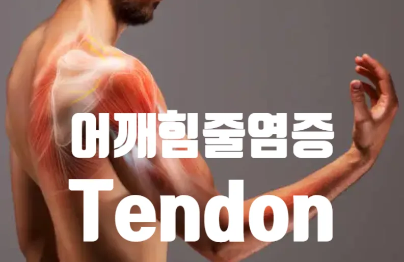어깨 힘줄 염증 회복 더딘 이유와 해결책 2026년 총정리 — 건강·의학 — yakooroo
