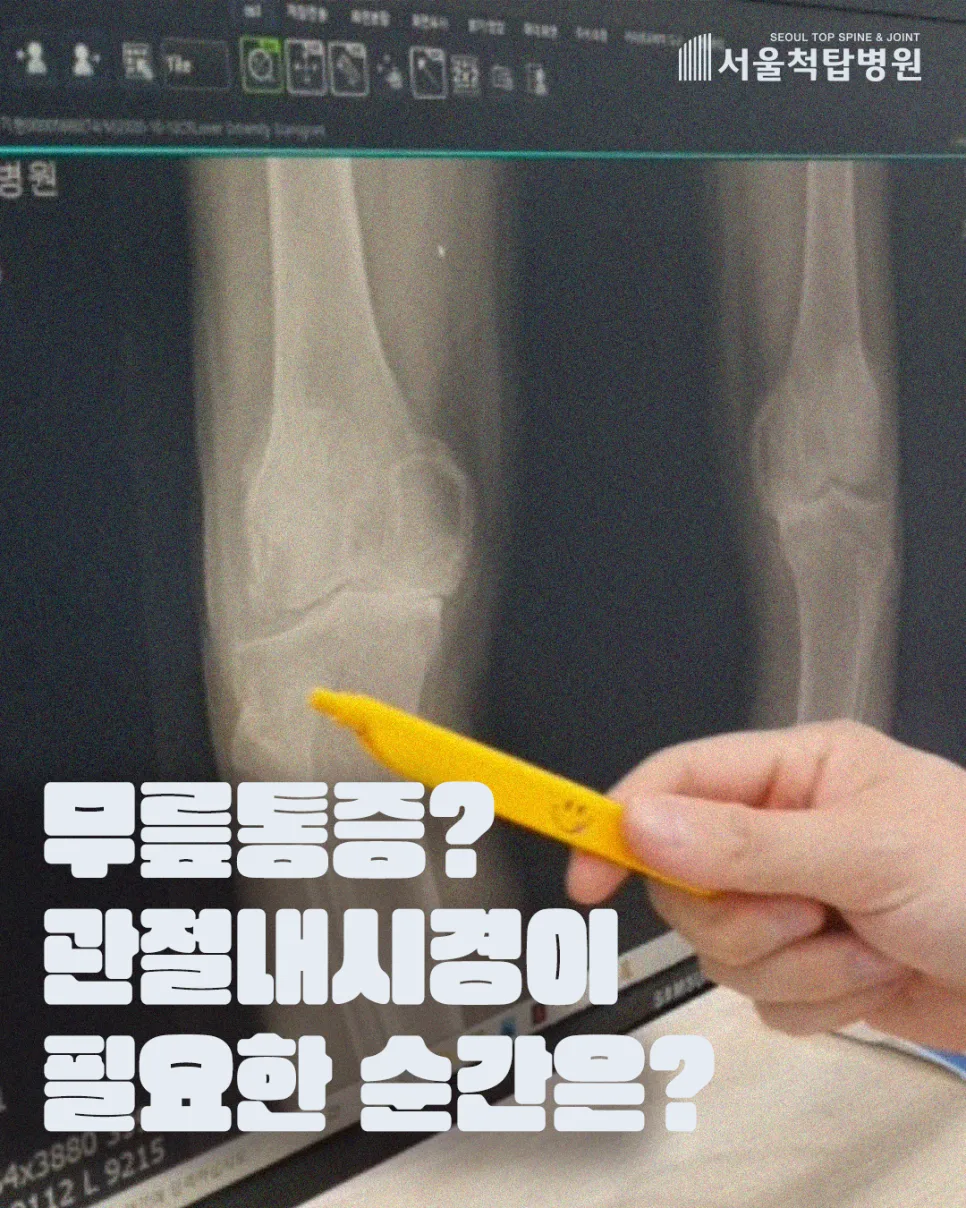 무릎 관절내시경 수술 2026: 통증 잡고 일상 복귀 빠른 방법