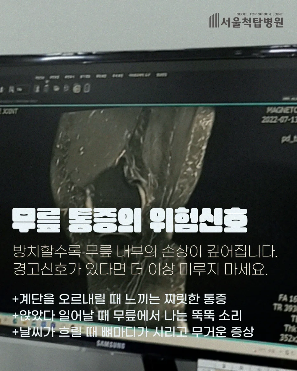 무릎 관절내시경 수술 2026: 통증 잡고 일상 복귀 빠른 방법 2