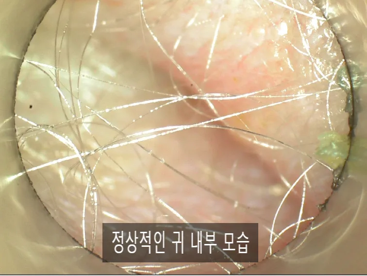 강아지 귀 진료, 2026년 최신 검사법과 진단 프로토콜 완벽 정리