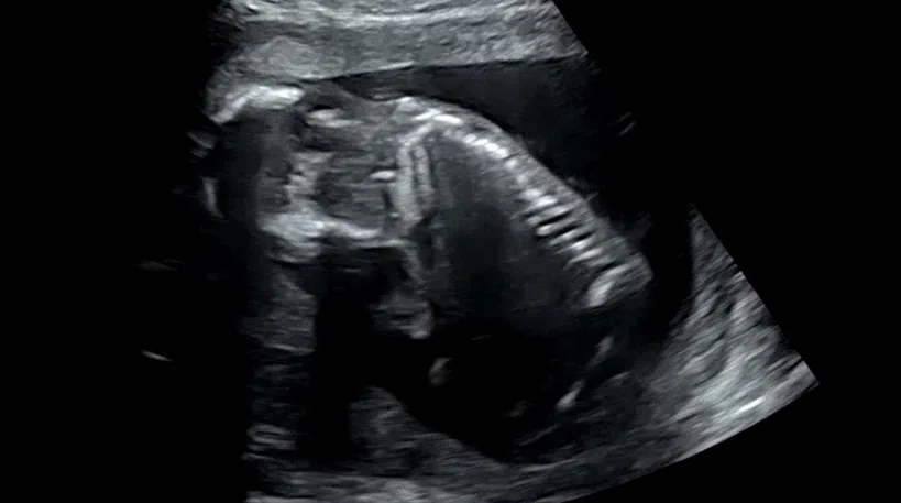 현대해상 태아보험 7만원대 가입 후기: 산모특약 포함 설계 2026