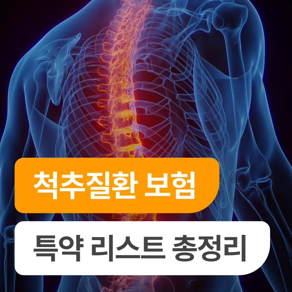 2026년 척추질환 보험 특약 완벽 분석: MRI부터 재활까지 보장 총정리