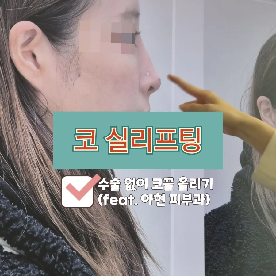 아현역 코 실리프팅 2026: 수술 없이 자연스러운 코 만들기