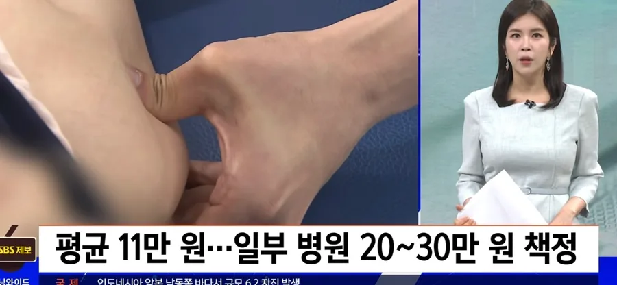 도수치료 가격 표준화 2026: 내 실손보험 보장 범위 확인법 2