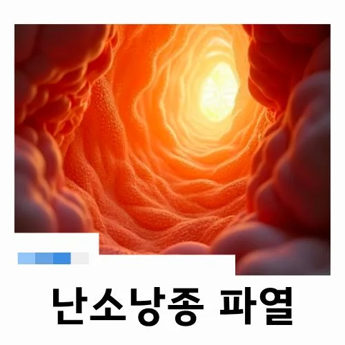 난소낭종 파열 응급 증상과 수술, 2026년 최신 정보 총정리